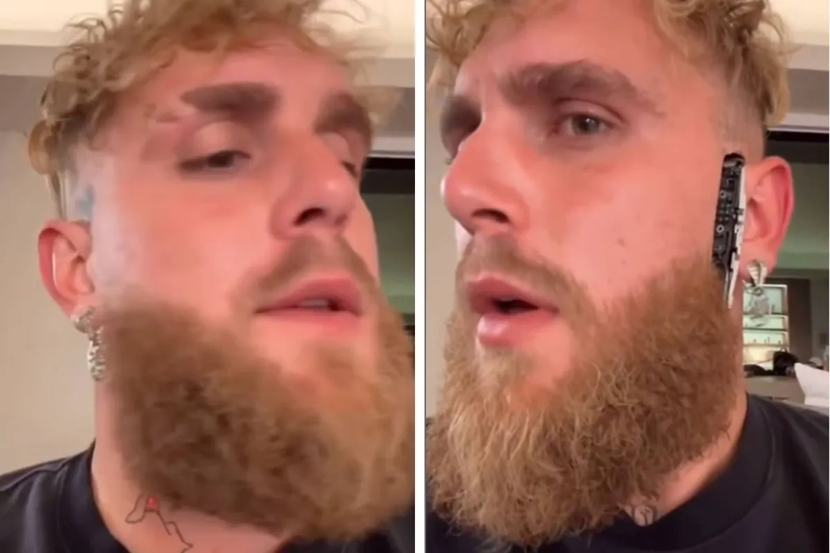 ‘Ik ben een machine?’ – Jake Paul onthult stalen 'robot kaak' na botsing met Joshua