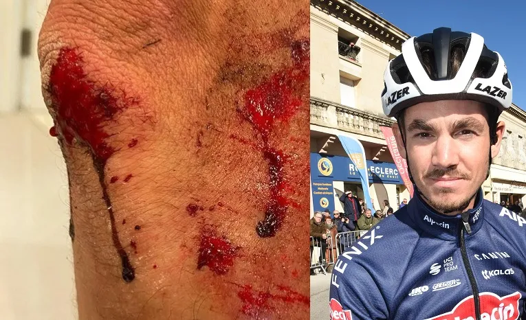 Richardson op brute wijze aangevallen en beroofd: 'Ze trokken een 15 inch machete'