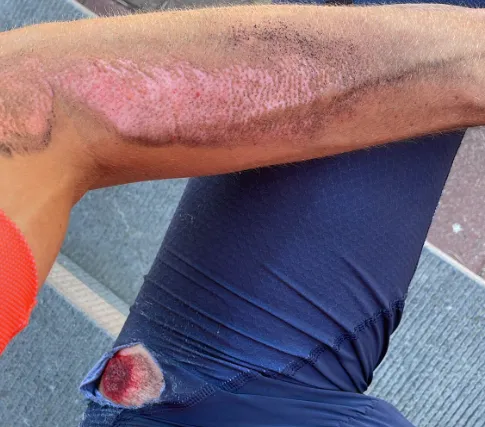 Ook De Plus aangereden op training: 'Ben alstublieft voorzichtig met de zwakke weggebruiker'