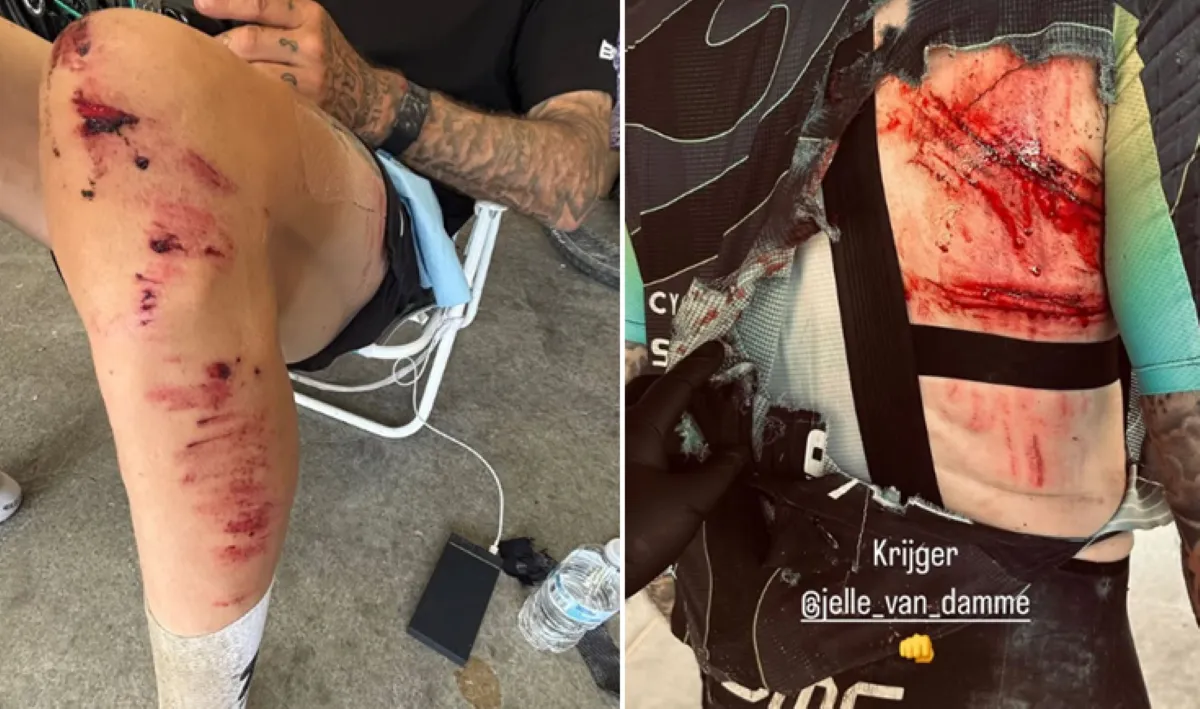 Voormalig Ajax-speler Jelle Van Damme belandt in prikkeldraad bij val tijdens Unbound Gravel