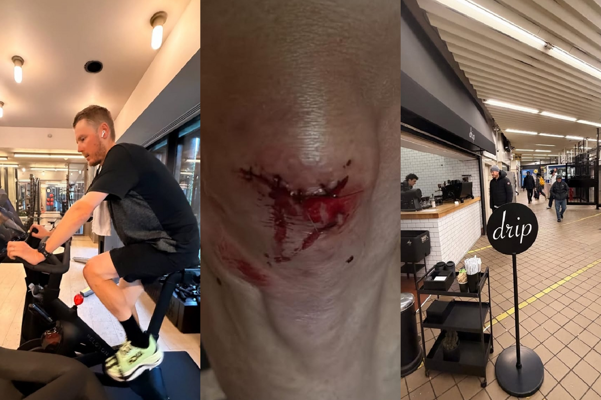 Van Baarle back on track after painful stitches, while Ferrand-Prévot shares less positive update after physical setback