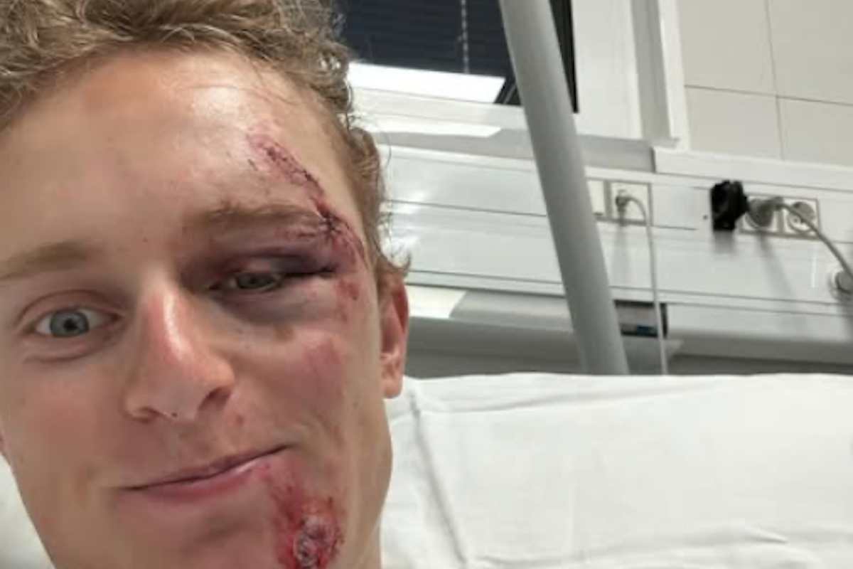 80kph training crash rocks Lidl-Trek's Albert Withen Philipsen: 'Sometimes sh*t happens'