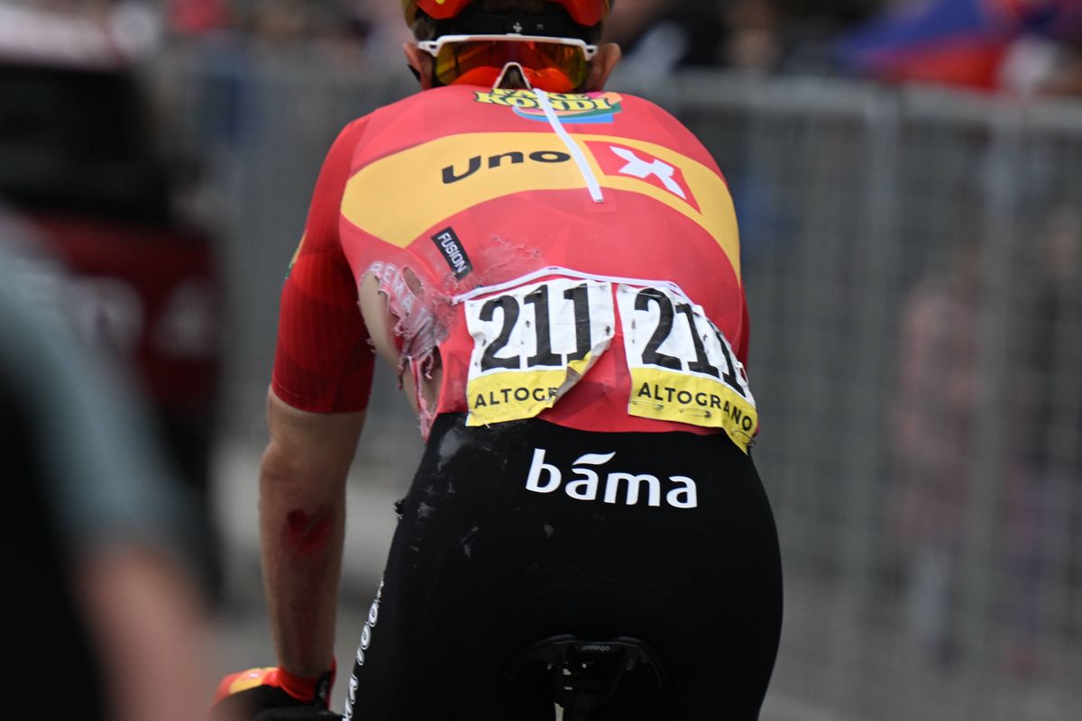 Bizarre: Cyclist apparently rode the Giro d'Italia for 10 days with four broken bones