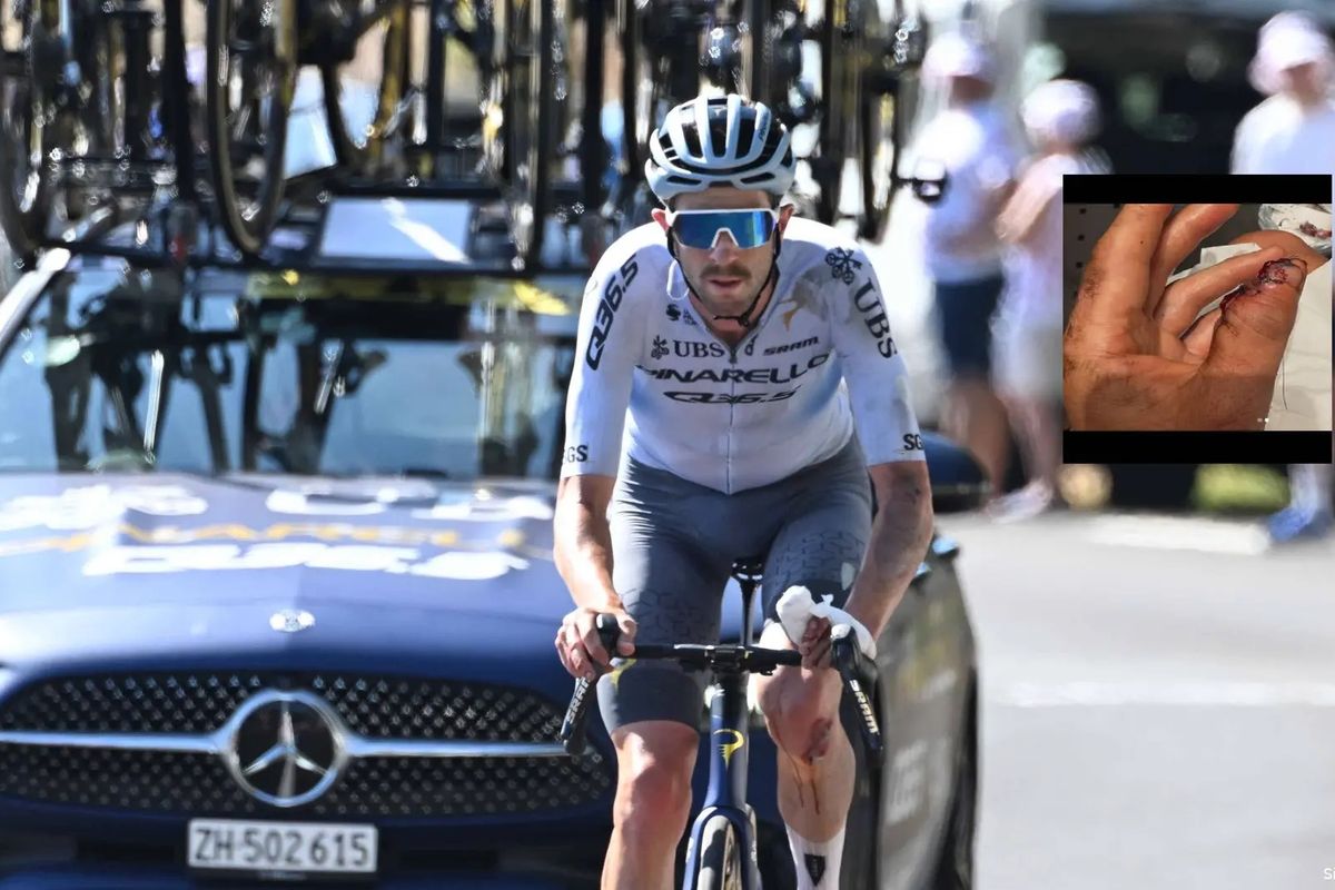 Not for the faint of heart: Australian Chris Harper lost part of his thumb in Tour de France crash