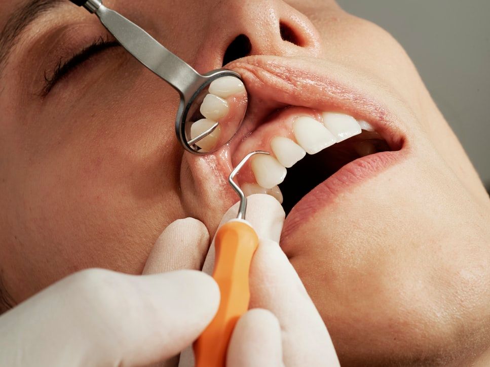 Tandartsen zien relatie tussen coronacrisis en tandenknarsers