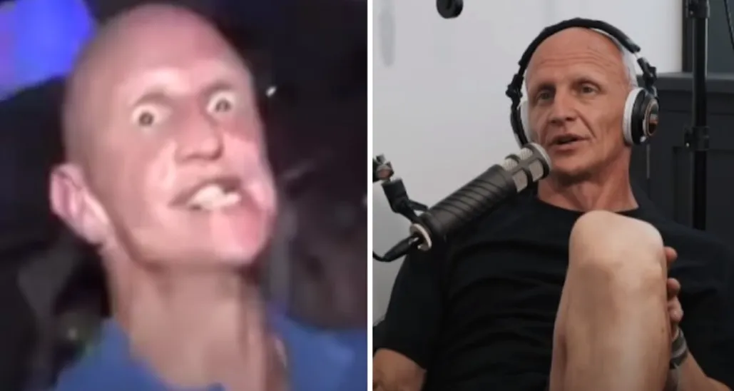 Beroemde 'Gurning Rave Guy' verklapt wat hij allemaal gebruikt had ...