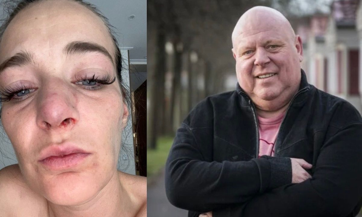 Nicol Kremers Laat Gruwelijke Foto s Van Mishandeling Door Peter Gillis 