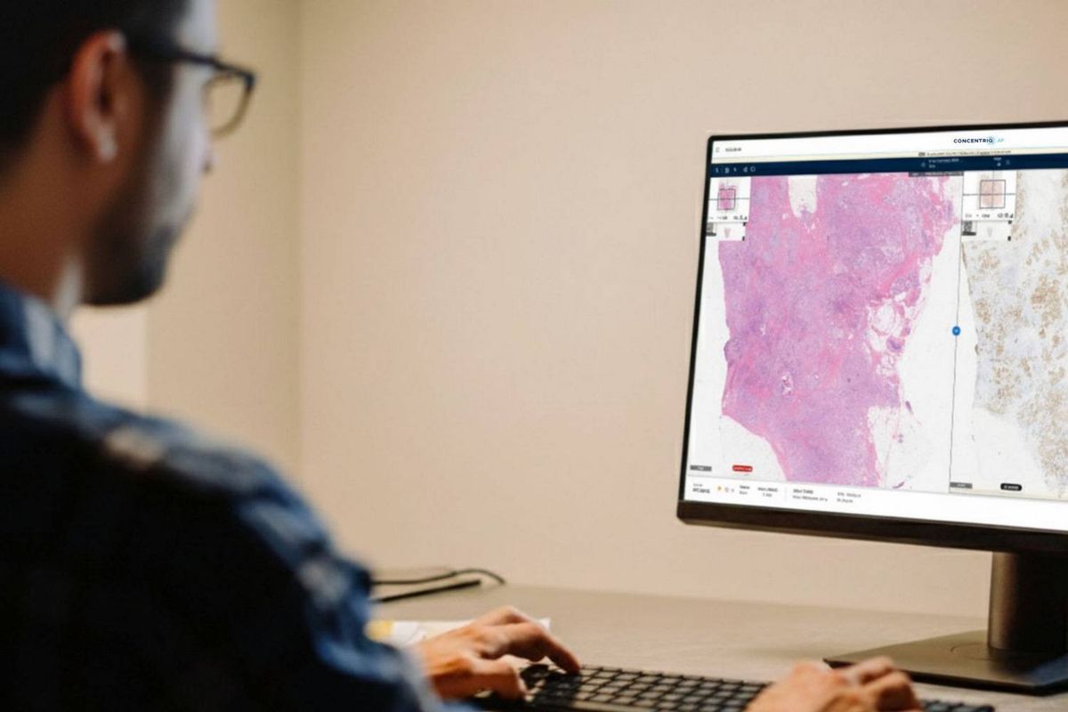 Spaarne Gasthuis op weg naar digitale pathologie