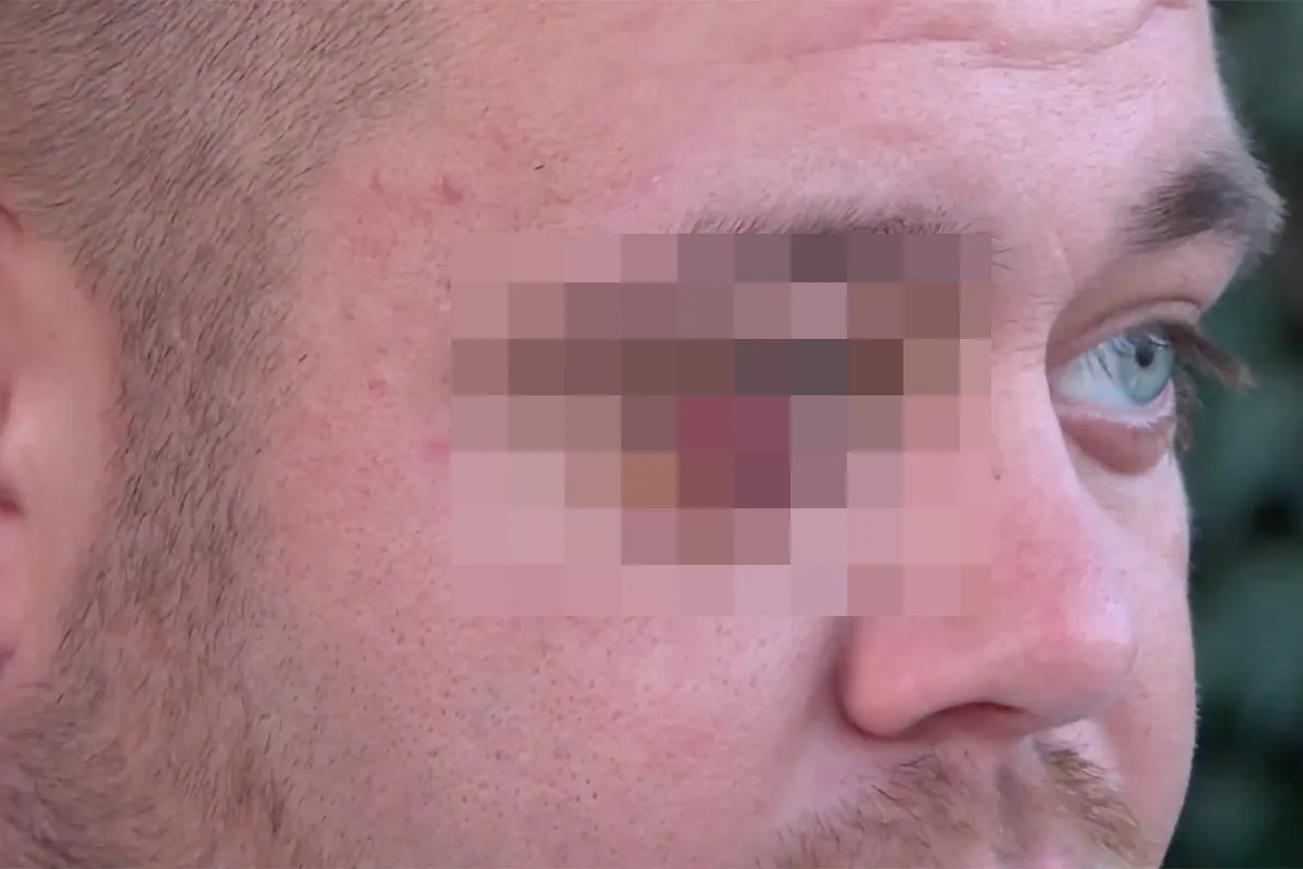 Mark Gillis, zoon van Peter 'Massa is Kassa' Gillis praat openhartig over gewelddadige overval