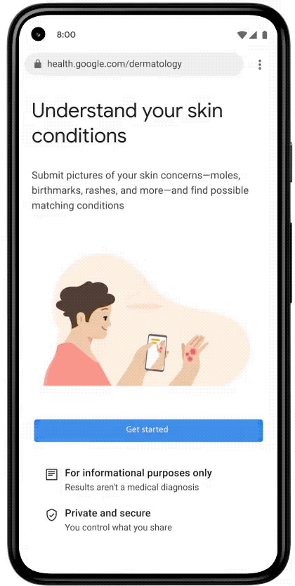 Zo gaat Google jou helpen om huidkanker op te sporen