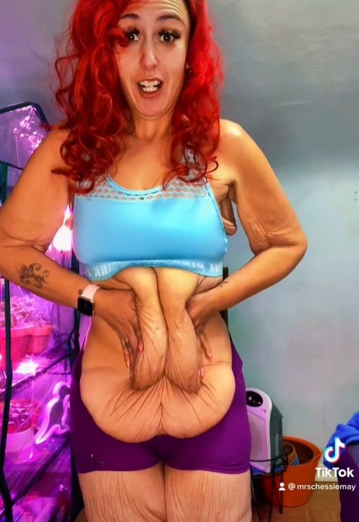 Chessie verloor 120 kilo en heeft extreem veel overtollige huid, die ze schaamteloos toont. "Ik vind het mooi"
