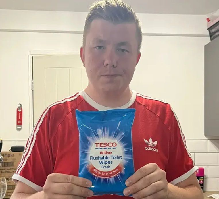 Kerel gebruikt anti-bacteriële doekjes als wc-papier en zijn achterwerk staat een week in brand