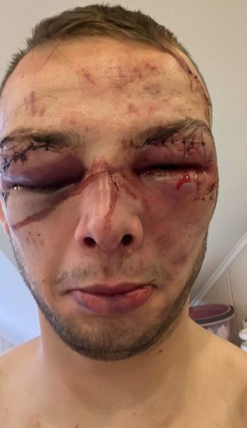 Hallucinant! MMA-rivalen onherkenbaar nadat ze tijdens kamp elkaars gezicht werkelijk vernielen