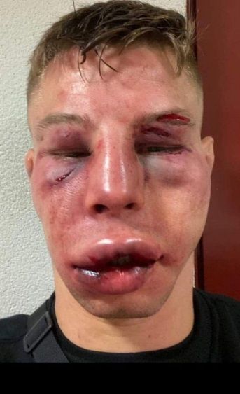 Hallucinant! MMA-rivalen onherkenbaar nadat ze tijdens kamp elkaars gezicht werkelijk vernielen