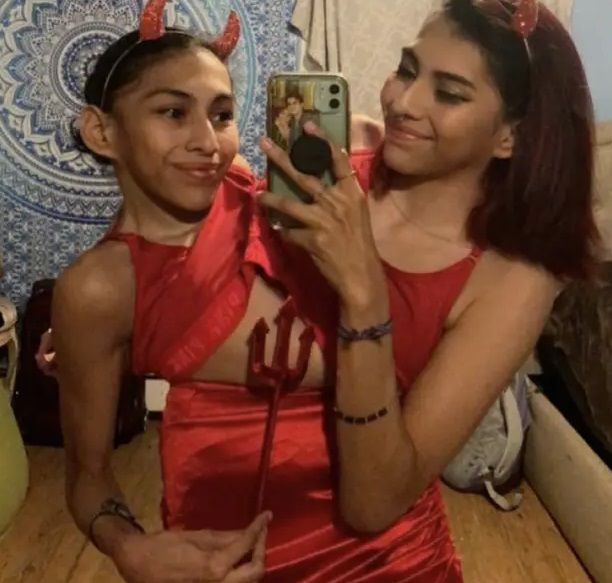 Siamese tweeling onthult dat één zus een lief heeft en de andere niet: "Intimiteit is lastig"