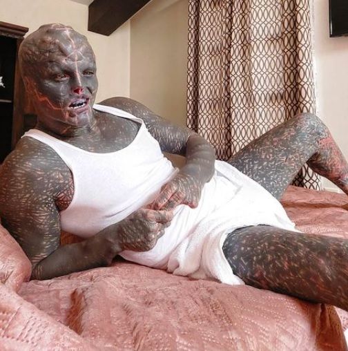 'Black Alien', die nu een been wil laten amputeren, zegt dat zijn moeder accepteert wie hij is