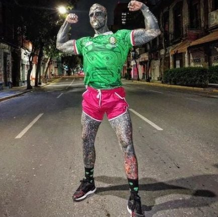 'Black Alien', die nu een been wil laten amputeren, zegt dat zijn moeder accepteert wie hij is