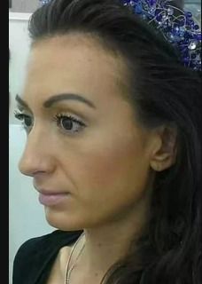 Model met 's werelds grootste wangen deelt foto van hoe ze eruitzag vóór plastische chirurgie
