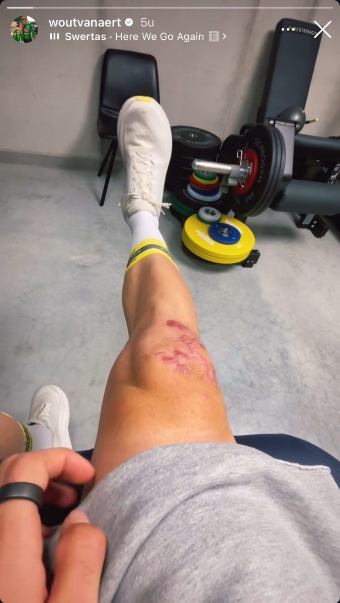 PHOTO: Wout van Aert shows off scars from season-ending Vuelta a Espana crash