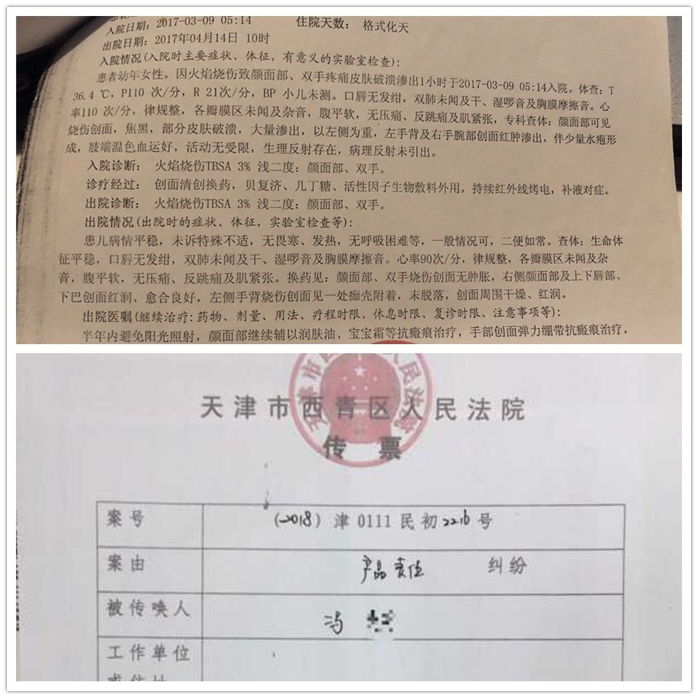 Galaxy Note 4 Explosion Deforms Girl - Family Sues For 1.69 Million Yuan ($249K)