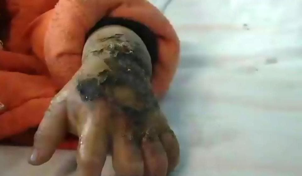 Galaxy Note 4 Explosion Deforms Girl - Family Sues For 1.69 Million Yuan ($249K)