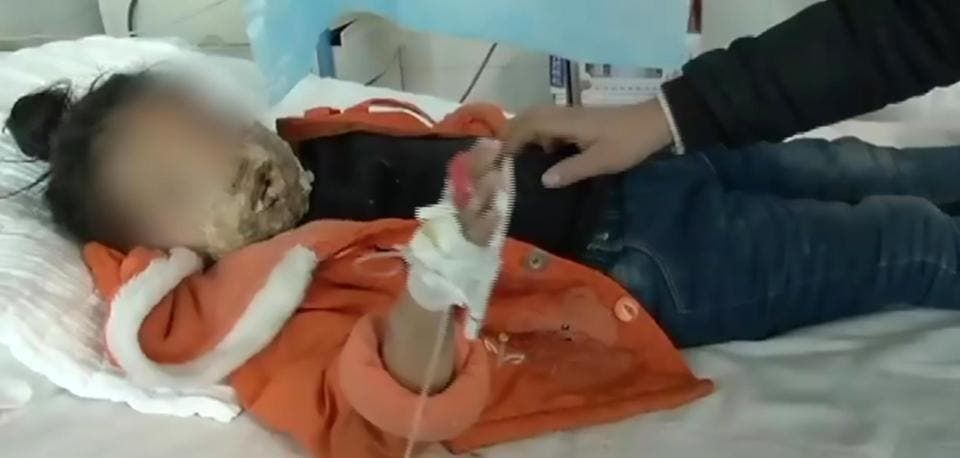 Galaxy Note 4 Explosion Deforms Girl - Family Sues For 1.69 Million Yuan ($249K)