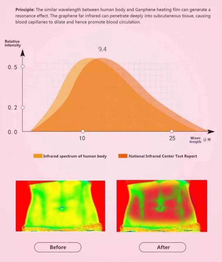 Treatment of Dysmenorrhoea with Graphene Far Infrared