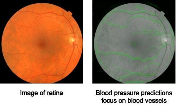 Google's AI Algorithm Detects Heart Diseases
