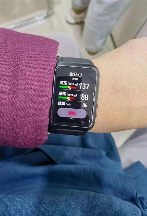 Huawei Watch D real image leaked - uses a square dial & measures high / low blood pressure