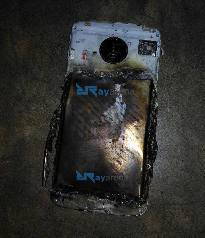 Moto E4 Plus Explosion Leave Burns On A Man's Leg In India