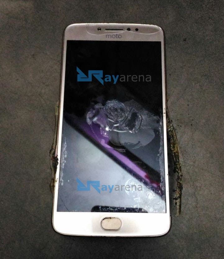 Moto E4 Plus Explosion Leave Burns On A Man's Leg In India