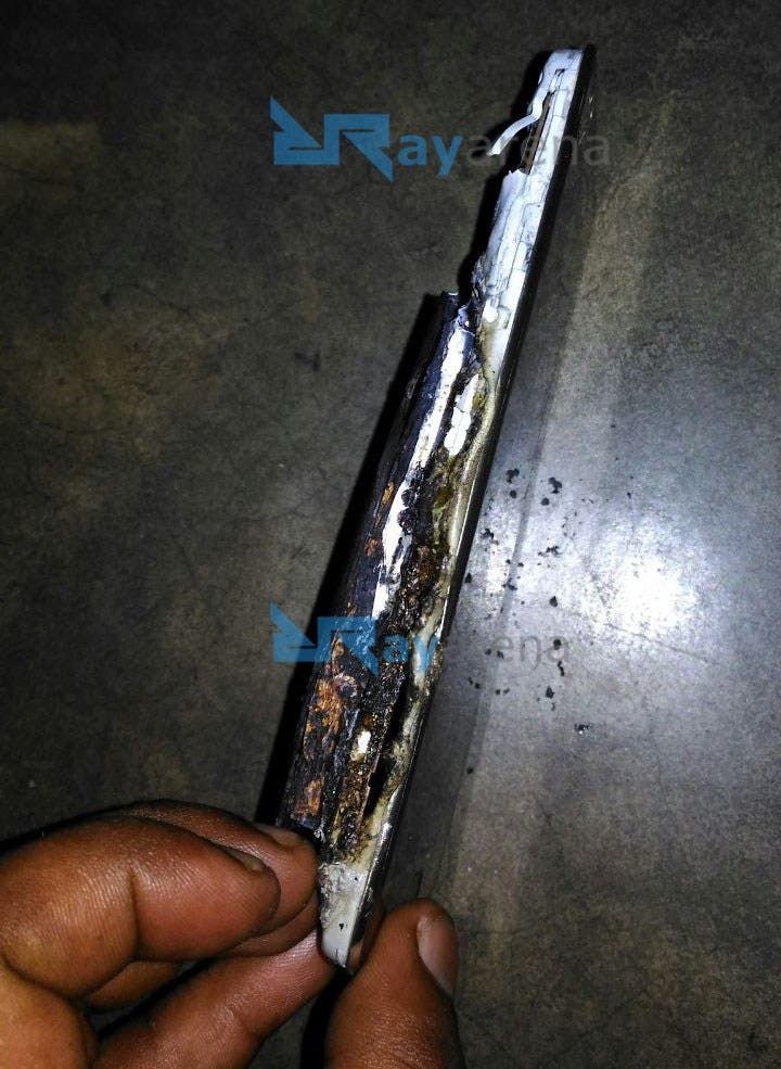 Moto E4 Plus Explosion Leave Burns On A Man's Leg In India
