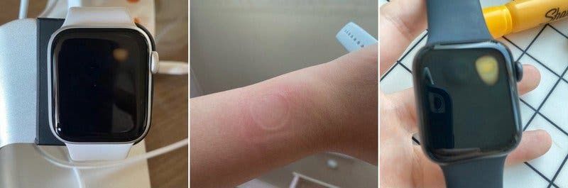 Apple Watch SE has a severe overheating issue