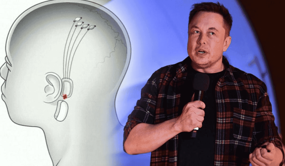 Elon Musk delays Neuralink presentation to November