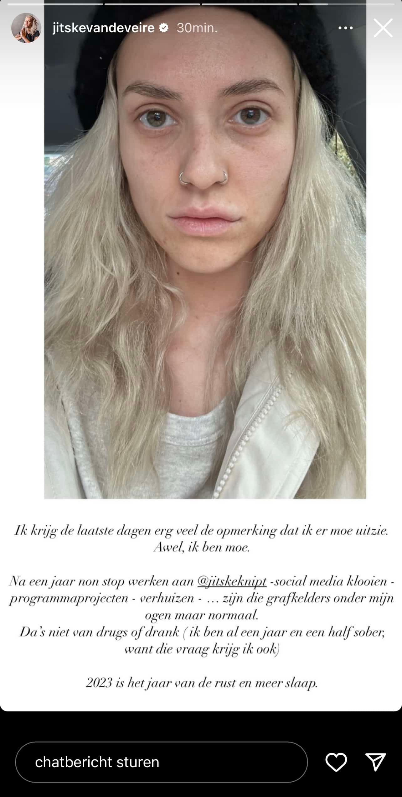 "Grafkelders onder mijn ogen": Jitske Van de Veire verrast volgers met eerlijke selfie zonder make-up