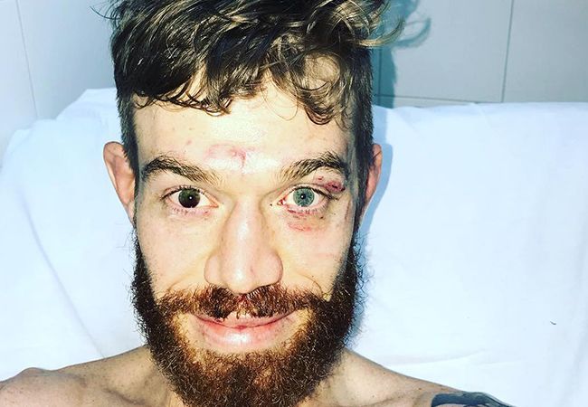 UFC Argentina: MMA-vechter half 'blind' tijdens gevecht
