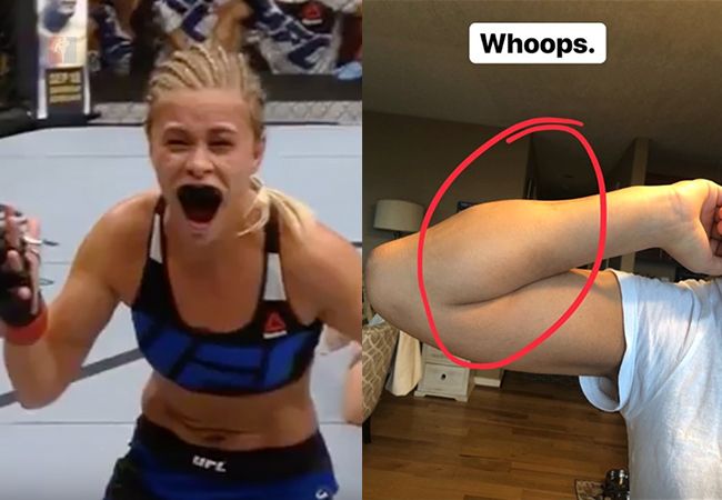 Heftig: MMA-vechter Paige VanZant deelt foto gebroken arm