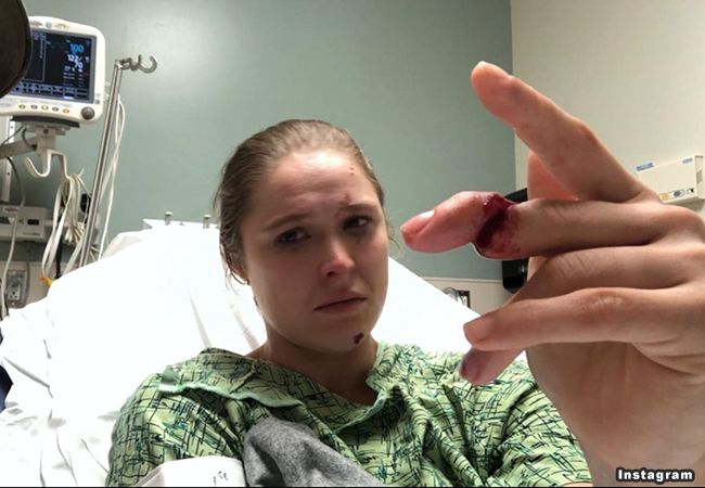 Bizar ongeluk: UFC Veteraan Ronda Rousey 'ernstig' gewond