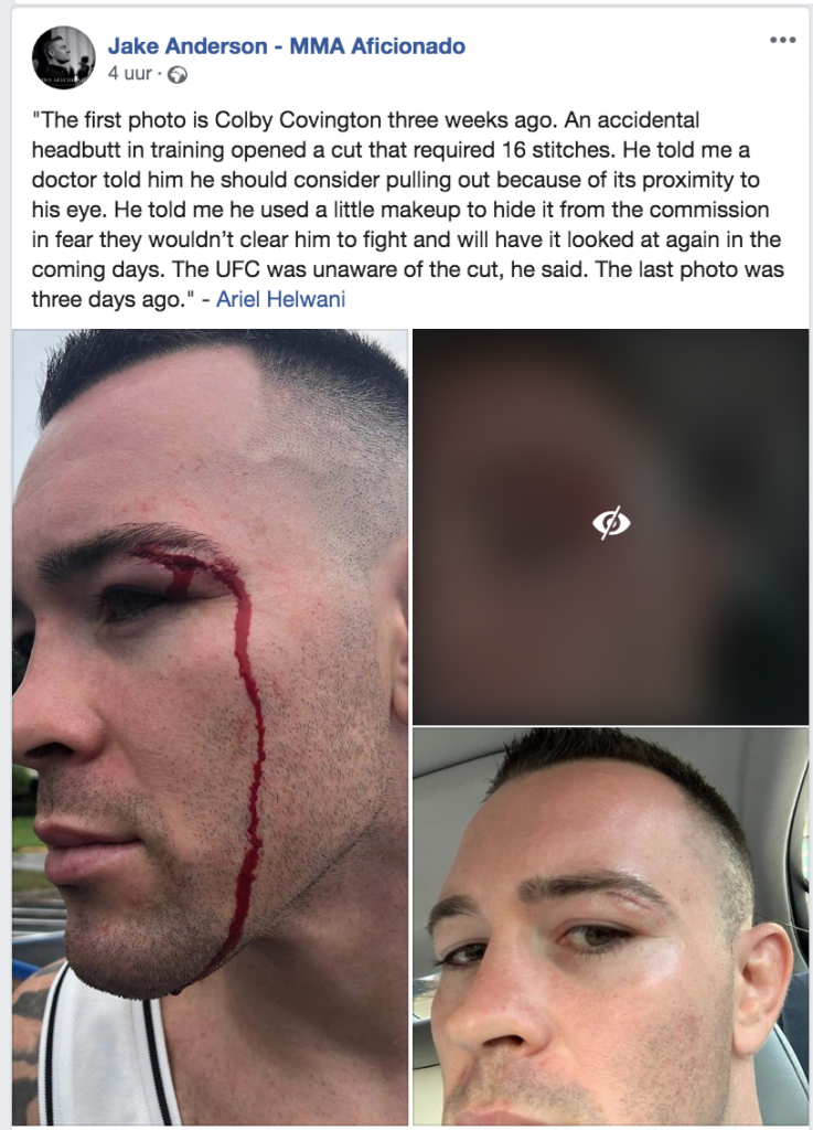 UFC-vechter Colby Covington zweeg over gevaarlijke blessure