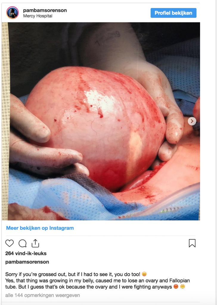 MMA-vechter deelt bizarre foto's: 'Ga op tijd naar een arts'