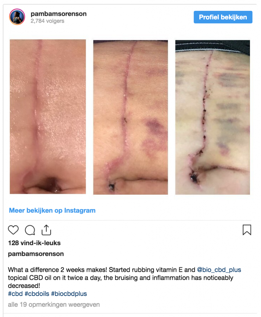 MMA-vechter deelt bizarre foto's: 'Ga op tijd naar een arts'