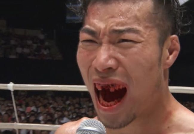 MMA-vechter 'tandloos' na elleboog: Wint toch wedstrijd (video)