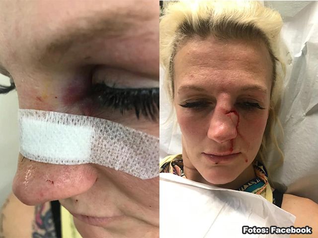 Belgische MMA-vechtster bruut mishandeld door ex-vriend