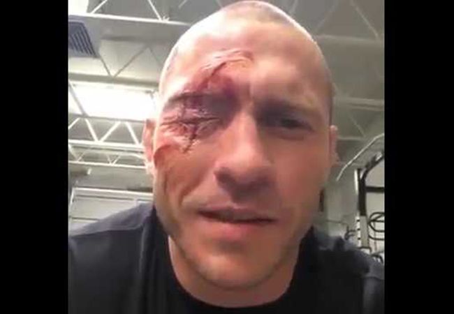 UFC-vechter met bijna 'ontploft' oog krijgt nieuw gevecht