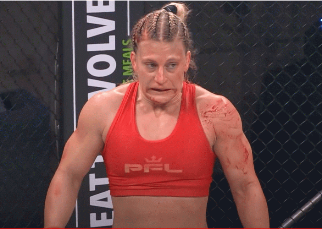 Met spoed naar ziekenhuis: Extreme afvalrace kost MMA-vechtster wedstrijd