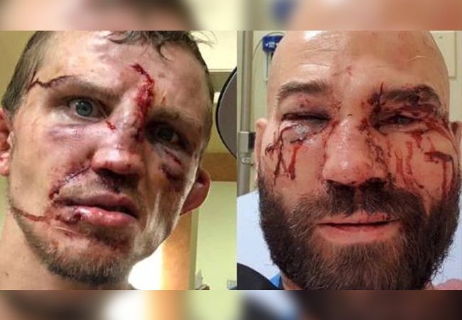 Heeft Bare Knuckle boksen een toekomst in Nederland?