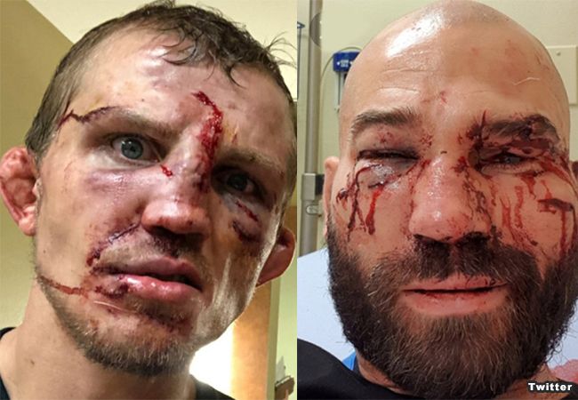 Bare Knuckle boksen: Artem Lobov en Jason Knight 'rematch'