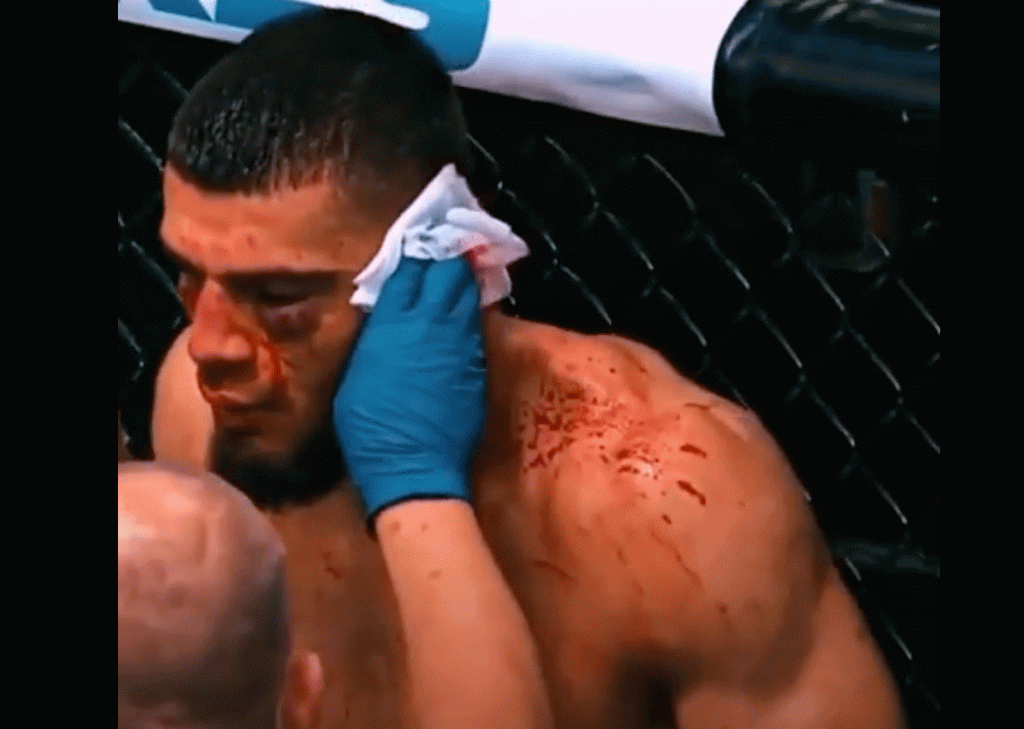 MMA-vechter laat afgescheurd oor tegenstander op zijn arm zetten (video)