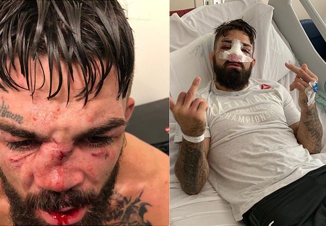 Zwaar toegetakelde UFC-vechter Mike Perry geopereerd