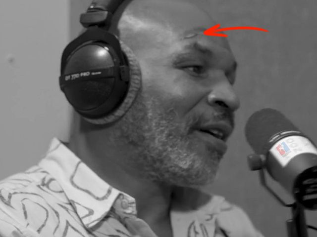 GEWOND: Mike Tyson loopt nare blessure op tijdens training
